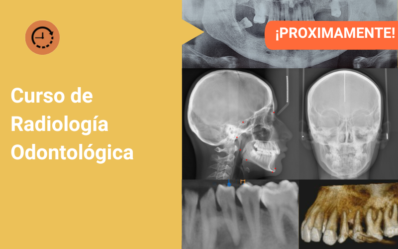 Curso de Radiología Odontológica